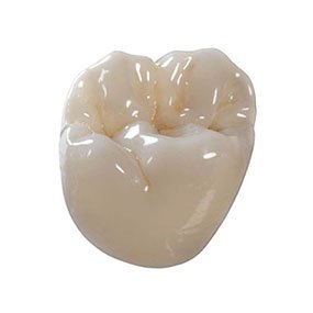 Full Contour Crown
