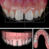 cadcam dental design dominican republic